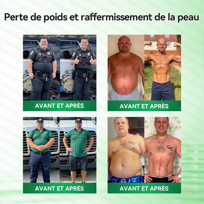𝑩𝒐𝒖𝒕𝒊𝒒𝒖𝒆 𝒐𝒇𝒇𝒊𝒄𝒊𝒆𝒍𝒍𝒆 | 👨‍⚕️🌿𝐆𝐋𝗢𝗥𝗘𝗡𝗗𝑨®𝑴𝒐𝒓𝒊𝐧𝐠𝙖 · 𝘽𝙚𝙧𝙗é𝙧𝒊𝒏𝒆 ×𝐍𝘼𝗗+ 𝟭0-𝒆𝒏-𝟏 𝐏𝐚𝙩𝙘𝙝 𝙈𝙞𝙘𝙧𝙤𝙣é𝙚𝒅𝒍𝒆 𝑨𝒗𝒂𝐧𝐜é 𝙉𝙖𝒏𝒐🇫🇷(𝐔𝐧𝐞 𝐬𝐞𝐮𝐥𝐞 𝐟𝐨𝐢𝐬 𝐩𝐚𝐫 𝐣𝐨𝐮𝐫, 𝐜𝐡𝐚𝐧𝐠𝐞𝐦𝐞𝐧𝐭𝐬 𝐯𝐢𝐬𝐢𝐛𝐥𝐞𝐬 𝐞𝐧 𝟕 𝐣𝐨𝐮𝐫𝐬） ✅ 𝐏𝐨𝐮𝐫 𝐥’𝐨𝐛é𝐬𝐢𝐭é, 🅟🅔🅐🅤 🅡🅔🅛â🅒🅗é🅔,𝐝𝐢𝐚𝐛è𝐭𝐞, 𝐚𝐩𝐧é𝐞 𝐝𝐮 𝐬𝐨𝐦𝐦𝐞𝐢𝐥, 𝐩𝐫𝐨𝐛𝐥è𝐦𝐞𝐬 𝐚𝐫𝐭𝐢𝐜𝐮𝐥𝐚𝐢𝐫𝐞𝐬, 𝐞𝐭 𝐛𝐢𝐞𝐧 𝐩𝐥𝐮𝐬